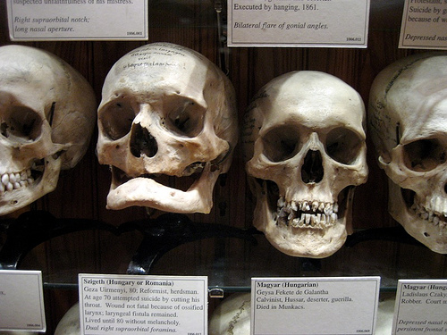 Just a few examples of the Hyrtal Skull Collection: 139 human skulls. 